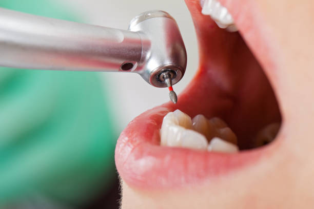 Best Broken or Chipped Tooth Repair in Phillips, WI